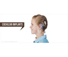 Decoding Sound: Innovations in Cochlear Implant Electrode Design and Function"