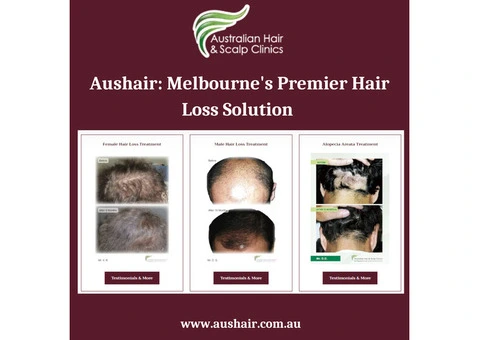 Get an Effective Male Hair Loss Treatment & Reclaim Your Confidence