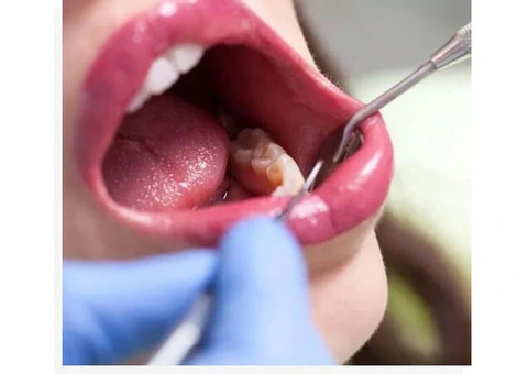 Top Dental Clinic Near Me for Expert General Dentistry in Banksia Grove