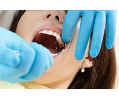 Choose the Best Dentist in Melbourne for Your Dental Care