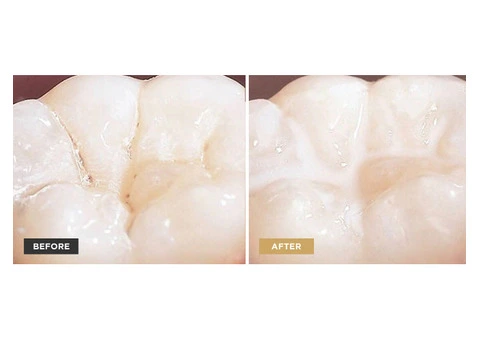 Top Children's Dentistry from Trusted Dental Clinic Near Me in Banksia Grove