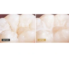 Top Children's Dentistry from Trusted Dental Clinic Near Me in Banksia Grove