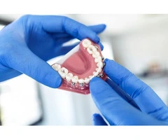 How Porcelain Veneers in Preston Are Applied