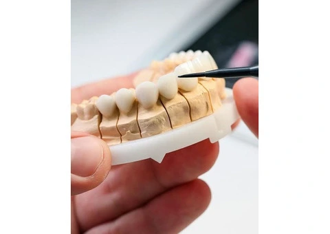 Want to learn more about the Cost of Teeth Porcelain Veneers