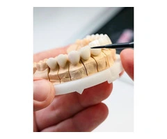 Want to learn more about the Cost of Teeth Porcelain Veneers