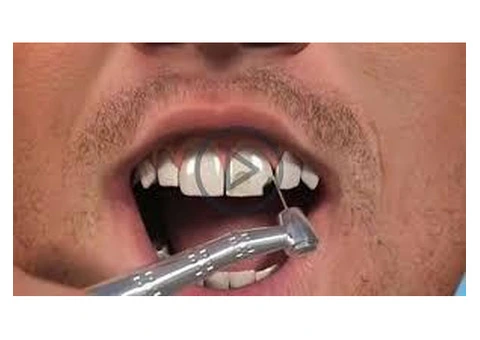 Teeth Whitening Treatment | Teeth Whitening Hampshire UK - LondonSummarize with AI Summarizer
