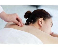 Dry Needling Adelaide