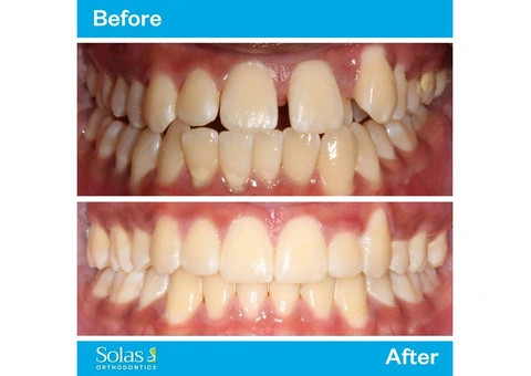 Solas Orthodontics - 1/13