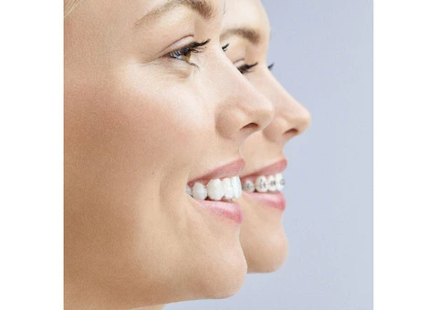 Solas Orthodontics - 5/13