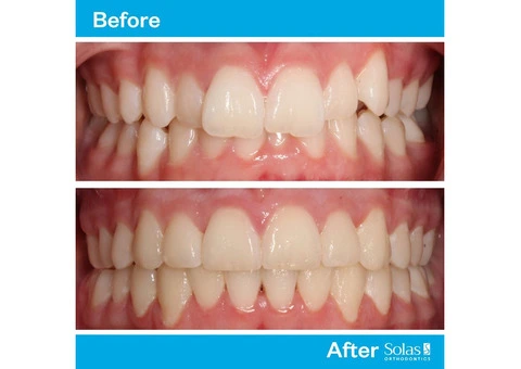 Solas Orthodontics - 8/13
