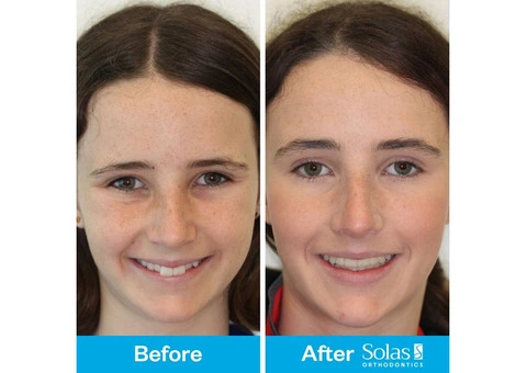 Solas Orthodontics - 9/13