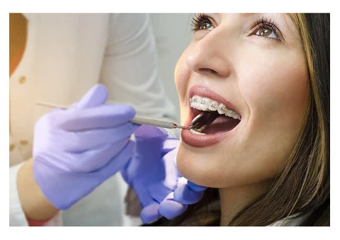 Teeth Whitening Parramatta