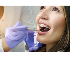 Teeth Whitening Parramatta