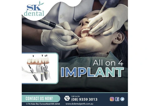 SK Dental Forrestfield - Dentist in Forrestfield - Dental Clinic in Forrestfield