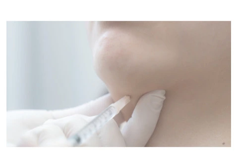 Double Chin Reduction & Removal in Melbourne | Dr. Green Cosmetic Group