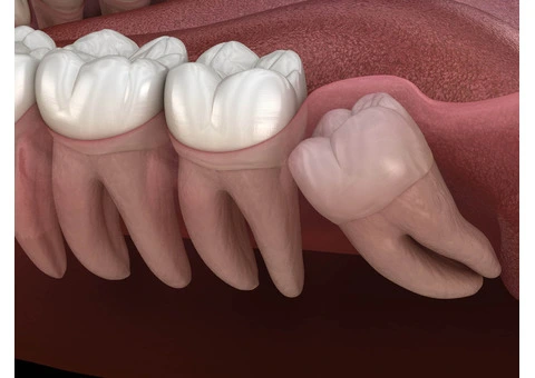 Fast and Reliable Emergency Dentist Appointment in Chatswood