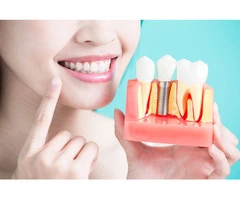 Transform Your Smile with Expert Implant Dentistry in Townsville