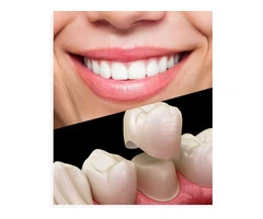 Transform Your Smile with Expert Cosmetic Dentistry in Banksia Grove