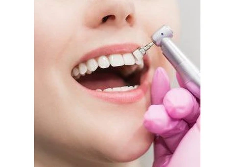 Transform Your Smile with Veneers: A Comprehensive Guide from Officer Dental Care