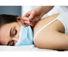 Dry Needling Adelaide