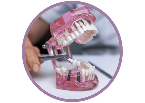 Comprehensive General Dentistry at Modern Dental Centre