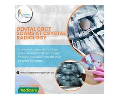 Dental CBCT scan at Crystal Radiology. (02) 8315 8292