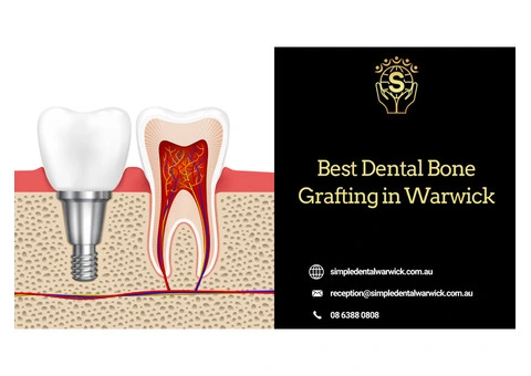 Trusted General Dentistry in Warwick