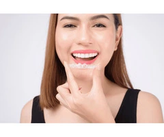 Invisalign Treatment for a Perfect Smile – Modern Dental Centre