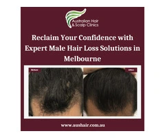 Regrow and Restore: Male Hair Loss Solutions in Melbourne