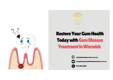 Restore Your Gum Health Today with Gum Disease Treatment in Warwick
