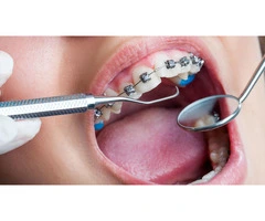 Affordable Dental Clinic Offering Full-Service Treatments