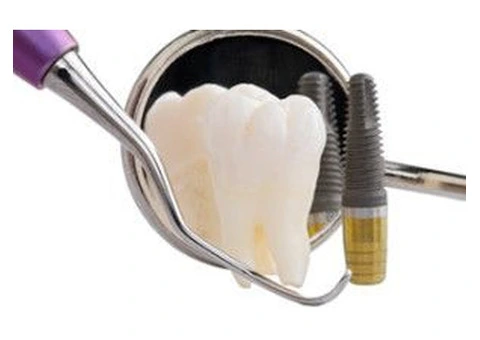 Unmatched Quality Dental Implants in Melbourne for Superior Results - 4/4