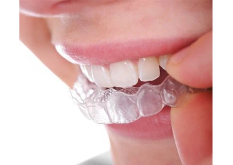 Digital Dental Implants in Sydney – Restore Your Smile with Confidence - 2/4