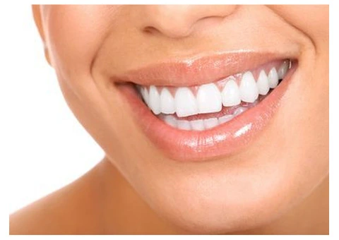 Digital Dental Implants in Sydney – Restore Your Smile with Confidence - 4/4