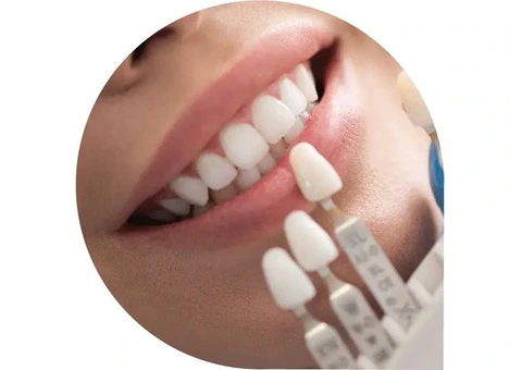 Lumina Dental - Your Glebe Dental Clinic for Comfort-Focused Care - 3/4