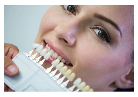 Transform Smile with Premium Dental Veneers in Box Hill
