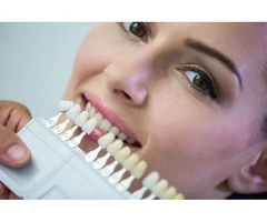 Transform Smile with Premium Dental Veneers in Box Hill