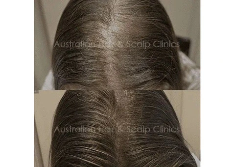 Achieve Silky, Smooth Hair with Brisbane’s Best Treatments