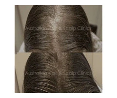 Achieve Silky, Smooth Hair with Brisbane’s Best Treatments