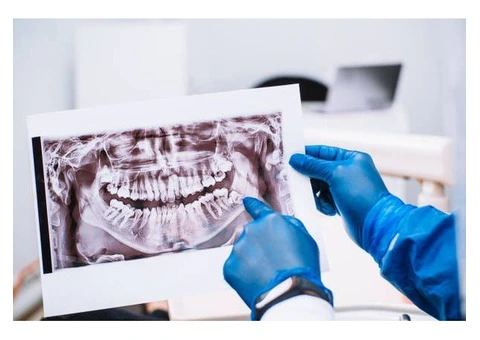 What is the average age to get your wisdom teeth removed?