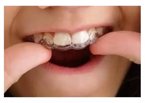 Affordable Invisalign Available Now