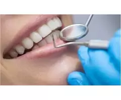 Professional Teeth Whitening in Preston | Achieve a Brighter Smile