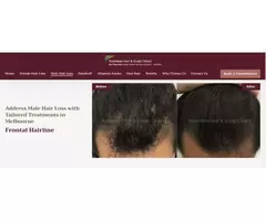 Address Male Hair Loss with Tailored Treatments in Melbourne