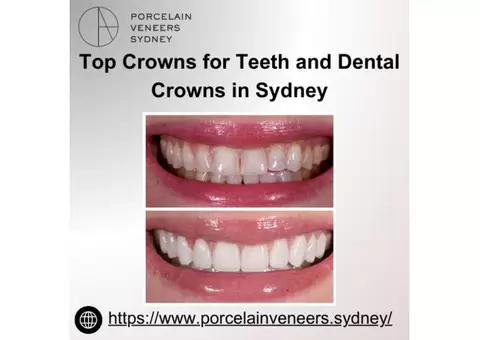 Top Crowns for Teeth and Dental Crowns in Sydney