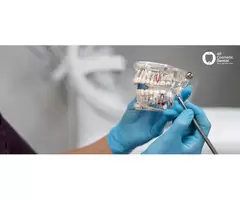 Your Ultimate Resource for Understanding Dental Crowns