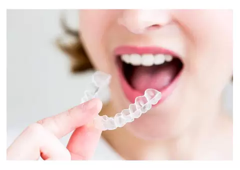 Affordable Braces Adults Love for Stunning Straight Smiles