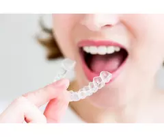 Affordable Braces Adults Love for Stunning Straight Smiles