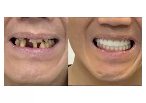 Best Cosmetic Clinic Melbourne - Cosmetic Avenue - 2/4