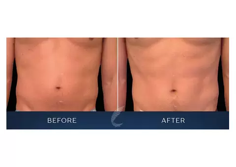 Best Cosmetic Clinic Melbourne - Cosmetic Avenue - 4/4