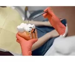 Affordable Dental Implants in Box Hill